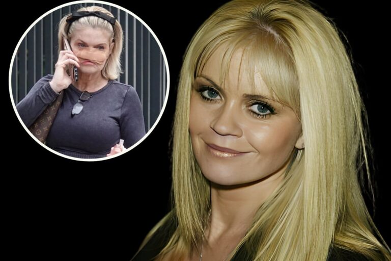 Danniella Westbrook Nose