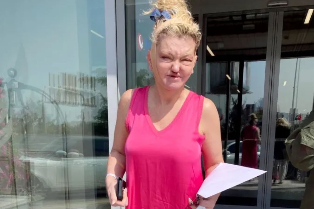 Knee Liposuction (1)