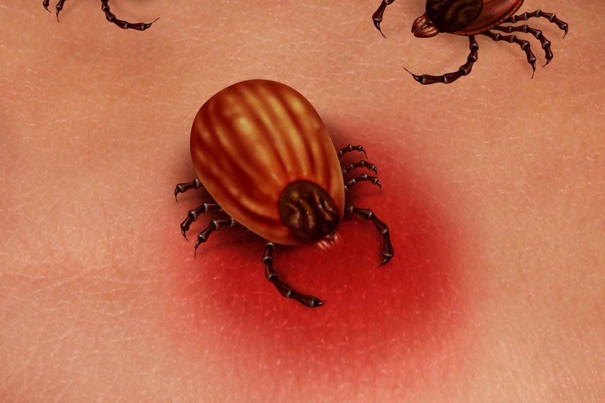 Lyme Disease tic byte