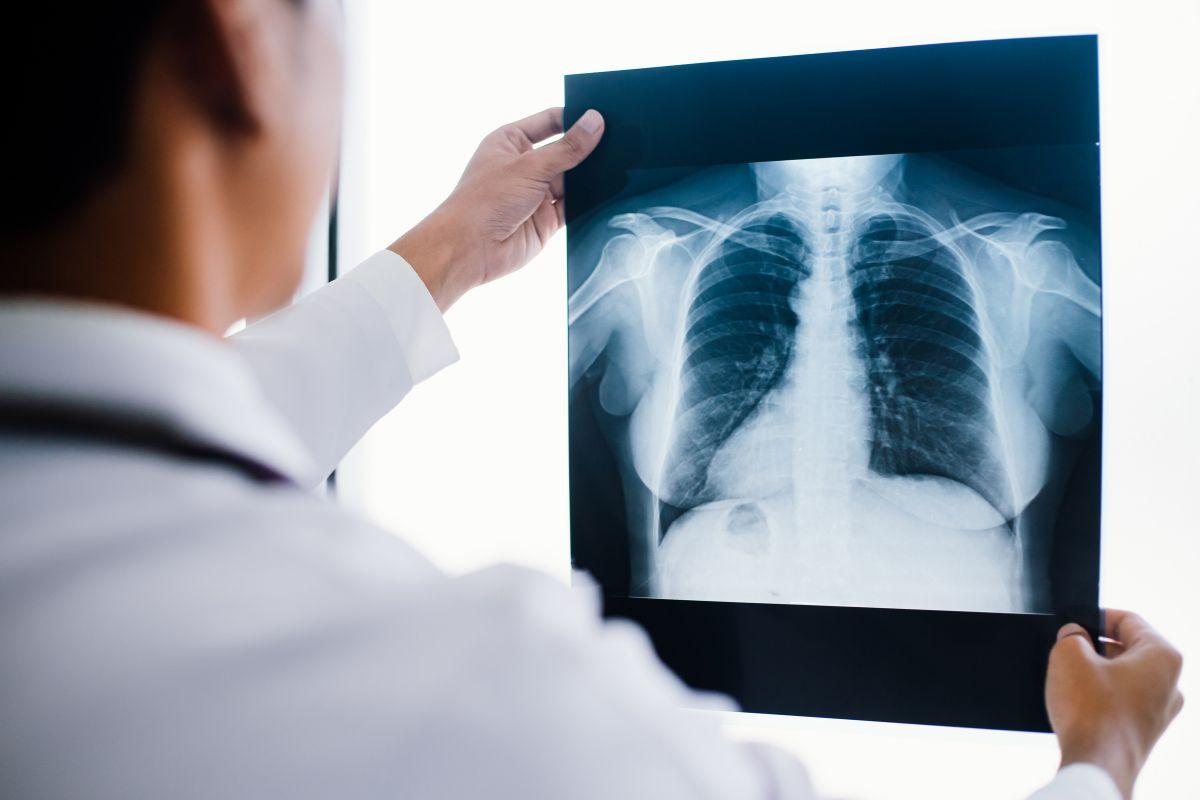 what is Chest Infection