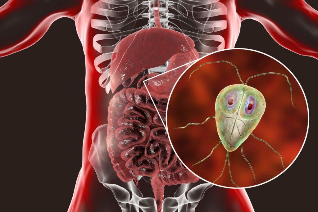 Is There A Stomach Bug Going Around Right Now Uk