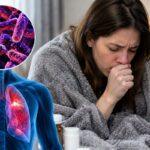 Pneumonic Plague