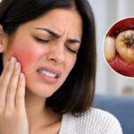 Tooth Infection