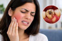 Tooth Infection
